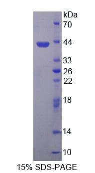 Human CBR3 Protein (Recombinant His-T7)