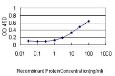 Monoclonal Mouse anti-Human CRYAB / Alpha B Crystallin Antibody (clone 1A10-1A4, WB)