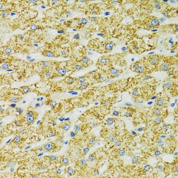 Polyclonal Rabbit anti-Human HSPA9 / Mortalin / GRP75 Antibody (IHC, IF, WB)