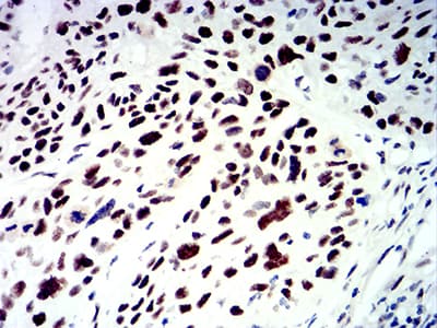 SMARCA1 / SWI Antibody (clone 2H7B8)