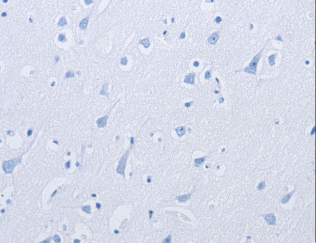 KCNMB3 Antibody (aa160-173)