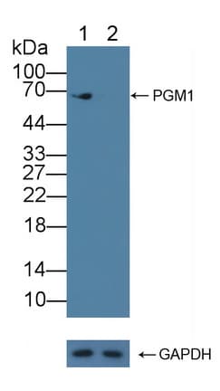 PGM1 / Phosphoglucomutase 1 Antibody (aa1-235)