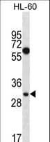 Polyclonal Rabbit anti-Human MED8 Antibody (aa95-122, WB)