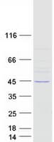 Human LRRC28 Protein (Recombinant Myc-DDK (Flag))