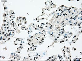 Monoclonal Mouse anti-Human BRAF / B-Raf Antibody (clone OTI4G6, IHC, WB)