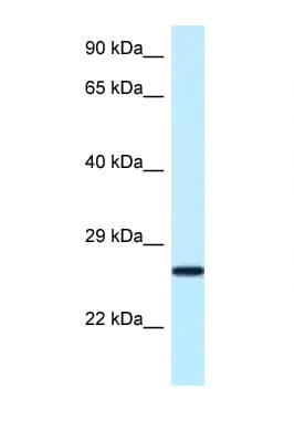 NUDT16 Antibody (aa45-94)