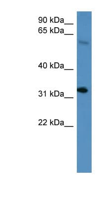 HOXD13 Antibody (aa174-223)