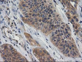 GBA3 / CBG Antibody (clone OTI1F1)