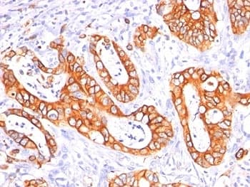 EMA / MUC1 Antibody (clone GP1.4 + E29, Ready-to-Use)