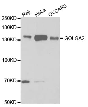IHC-plus™ Polyclonal Rabbit anti-Human GOLGA2 / GM130 Antibody (IHC, IF, WB)