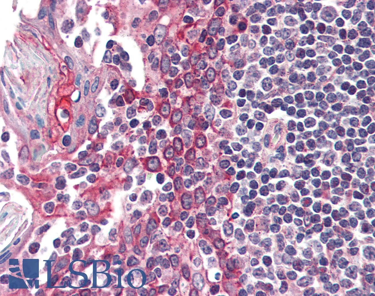 IHC-plus™ CSNK1E / CK1 Epsilon Antibody (aa403-416)