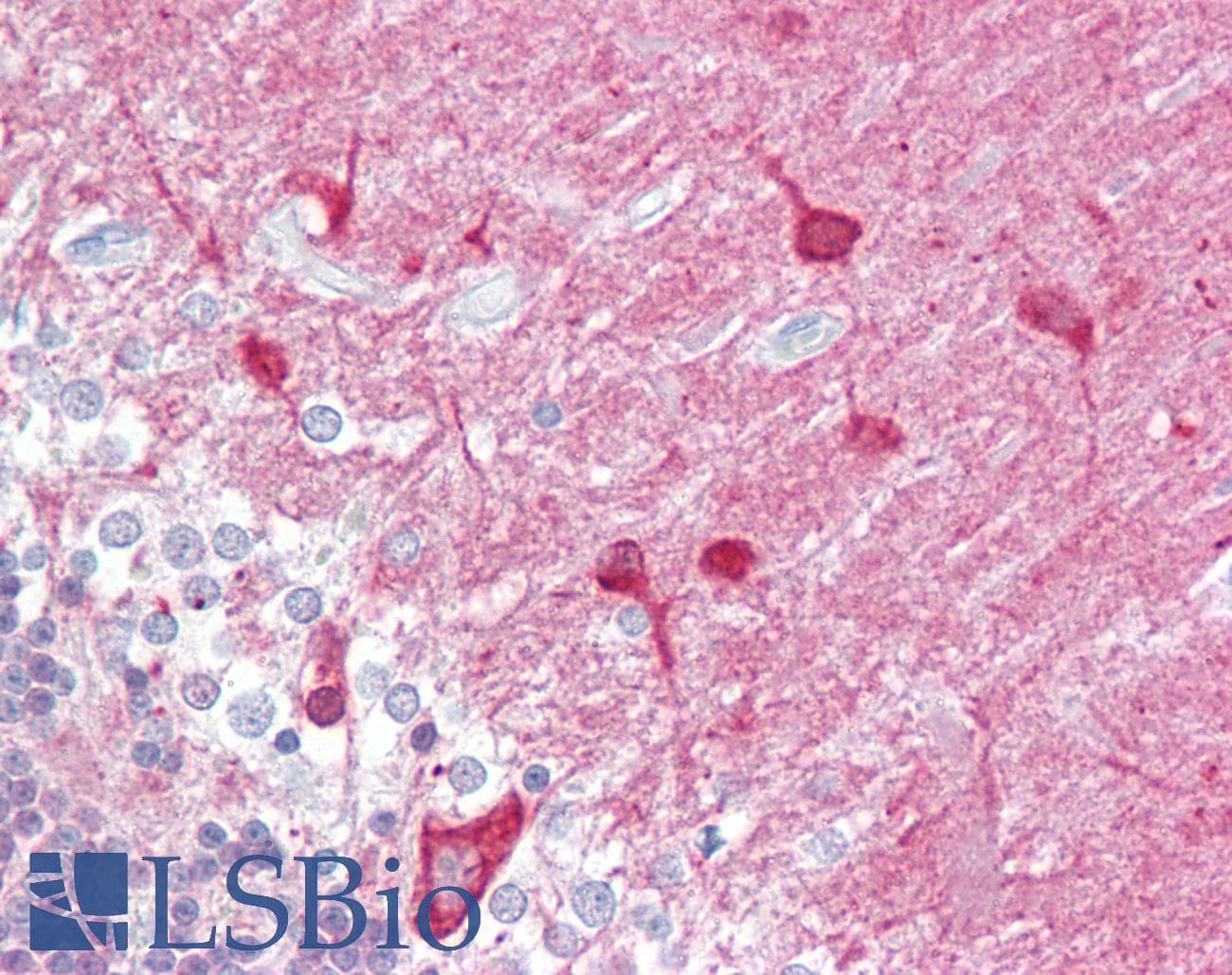 IHC-plus™ Polyclonal Goat anti-Human Syndapin I / PACSIN1 Antibody (aa2-15, IHC, WB)
