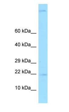 GKN2 / Gastrokine 2 Antibody (aa31-80)