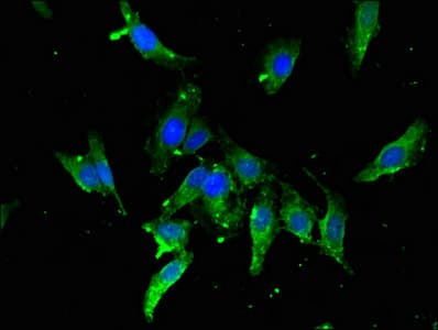TBP / GTF2D Antibody