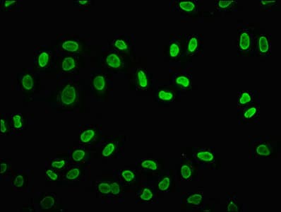 HIST1H2BN Antibody