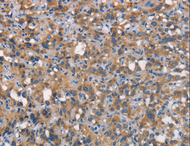 CD66c / CEACAM6 Antibody
