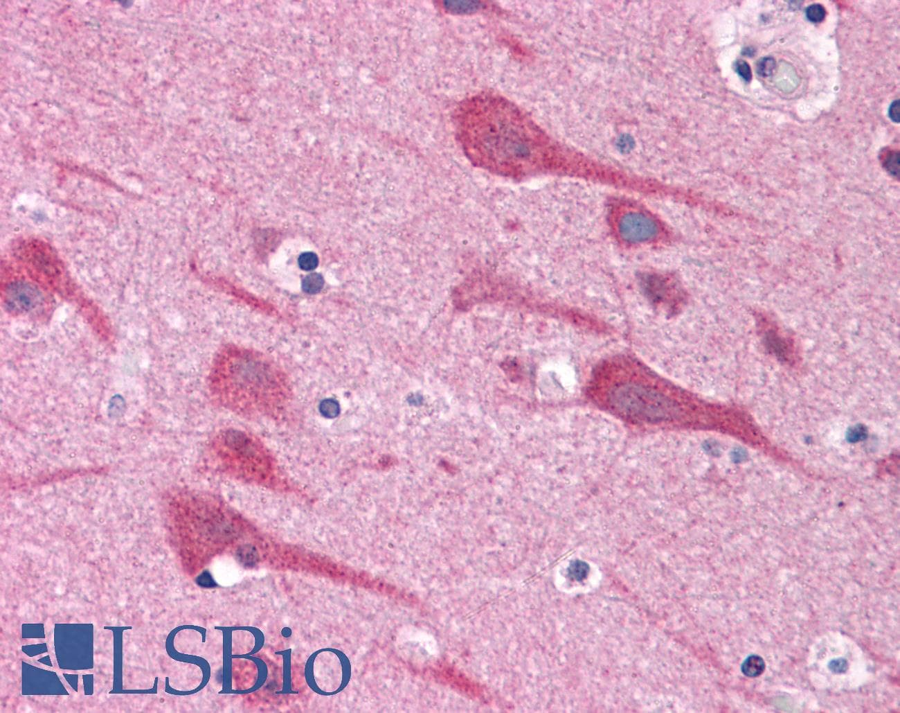IHC-plus™ Polyclonal Rabbit anti-Human TAB2 Antibody (IHC)