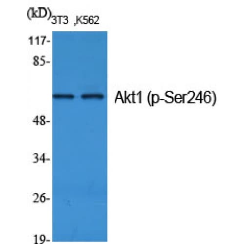 Polyclonal Rabbit anti-Human AKT1 Antibody (180-260 aa, IHC, IF, WB)