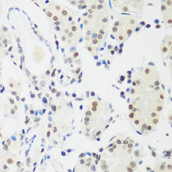 MECP2 Antibody