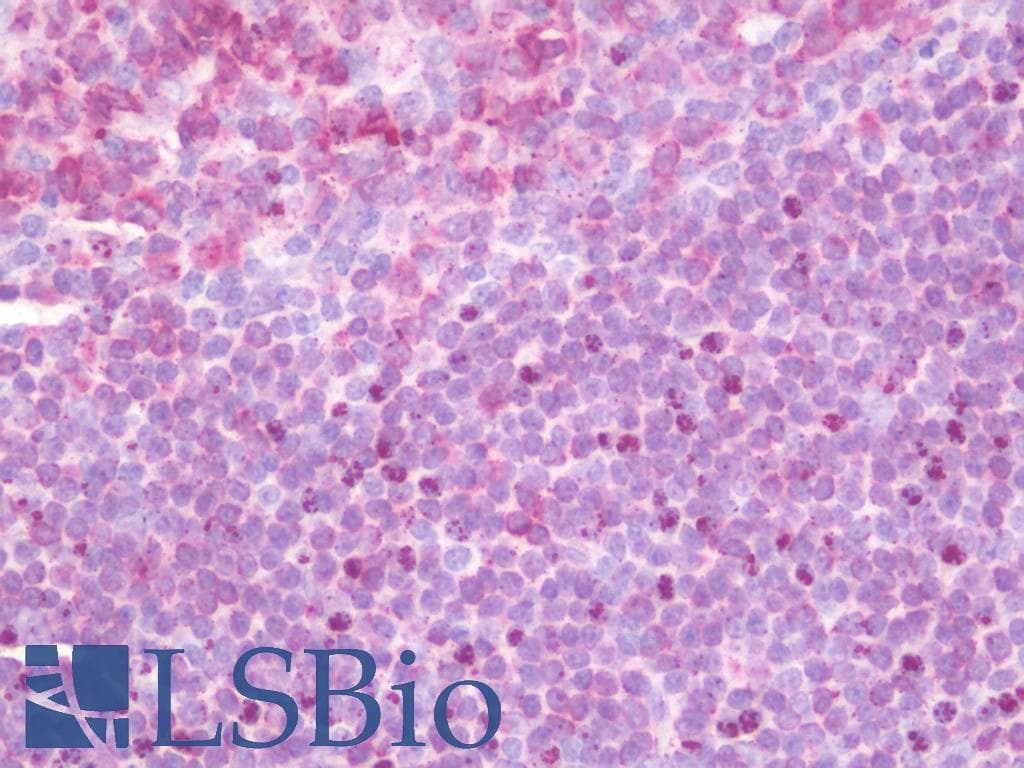 IHC-plus™ ULK2 Antibody
