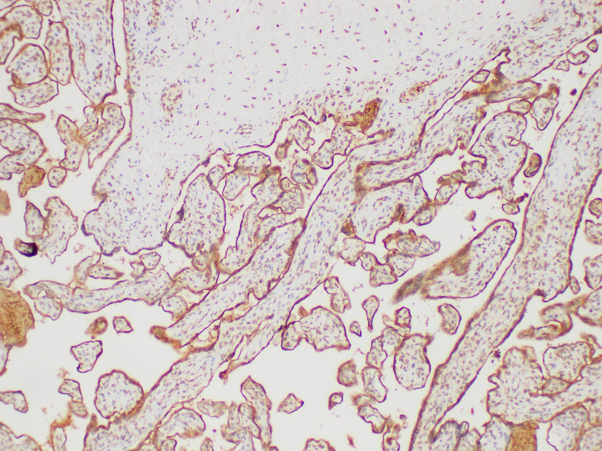FGG / Fibrinogen Gamma Antibody
