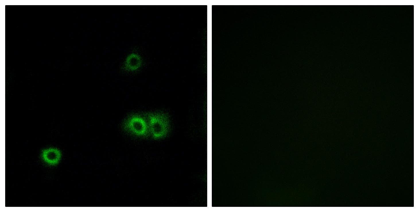 MARCH5 Antibody