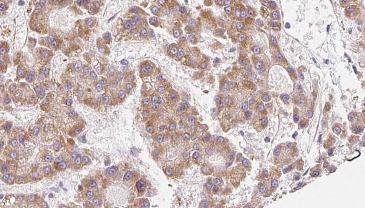 SCNN1A / ENaC Alpha Antibody