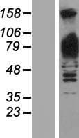 GPBB / PYGB Protein (Over-Expression Lysate Myc-DDK (Flag))