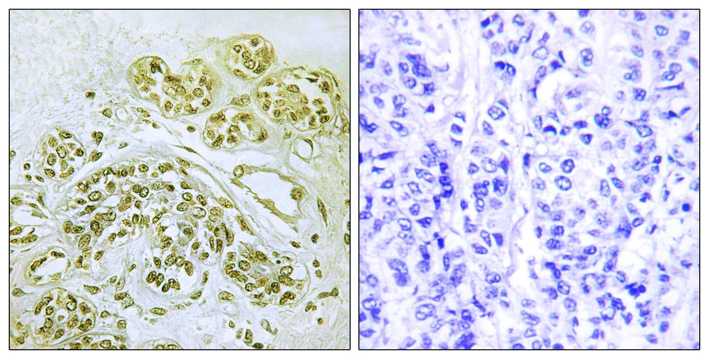 Polyclonal Rabbit anti-Human NFKBIA / IKB Alpha / IKBA Antibody (phospho-Tyr42, IHC)