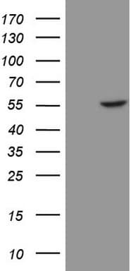 Monoclonal Mouse anti-Human KRT16 / CK16 / Cytokeratin 16 Antibody (clone OTI2F10, WB)