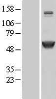 CAMK2A / CaMKII Alpha Protein (Over-Expression Lysate Myc-DDK (Flag))