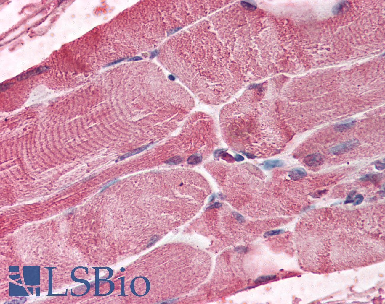 IHC-plus™ Polyclonal Goat anti-Human BMI1 / PCGF4 Antibody (IHC, IF, WB)