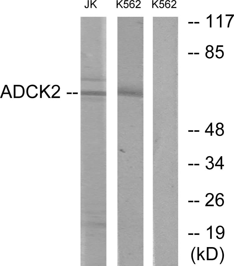 ADCK2 Antibody (aa241-290)