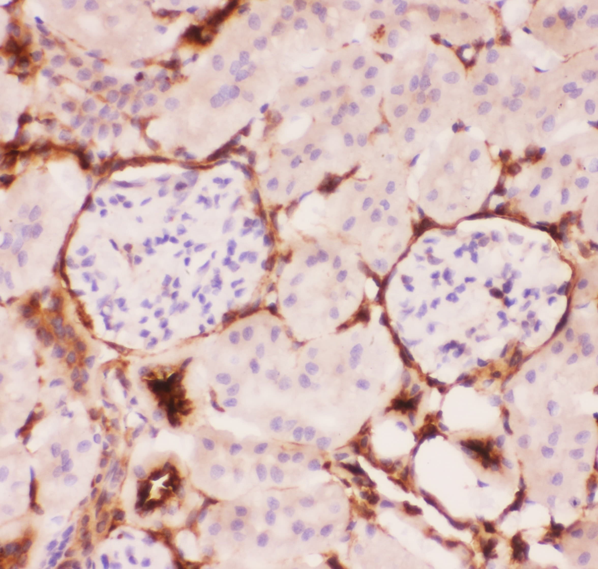 ABCB1 / MDR1 / P Glycoprotein Antibody (aa621-650)