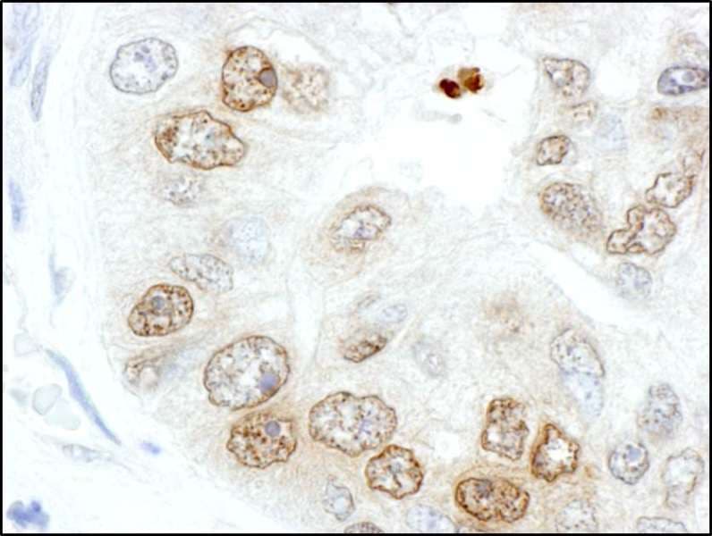 H2AFX / H2AX Antibody (phospho-Ser140)
