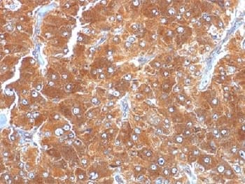 PLIN2 / ADFP / Adipophilin Antibody (clone ADFP/1494)