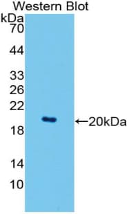 FABP9 / Lipid-Binding Protein Antibody (aa1-130)