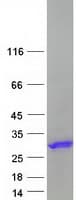 Human ZBTB8OS Protein (Recombinant Myc-DDK (Flag))
