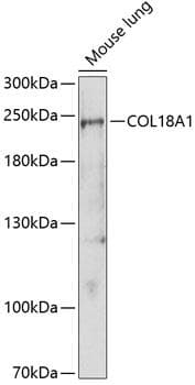 Endostatin Antibody