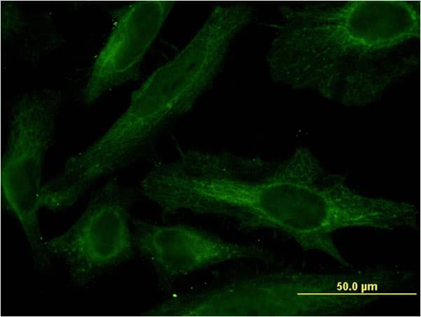PDE4C Antibody (clone 4E5)