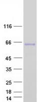 Human MATN3 / Matrilin 3 Protein (Recombinant Myc-DDK (Flag))