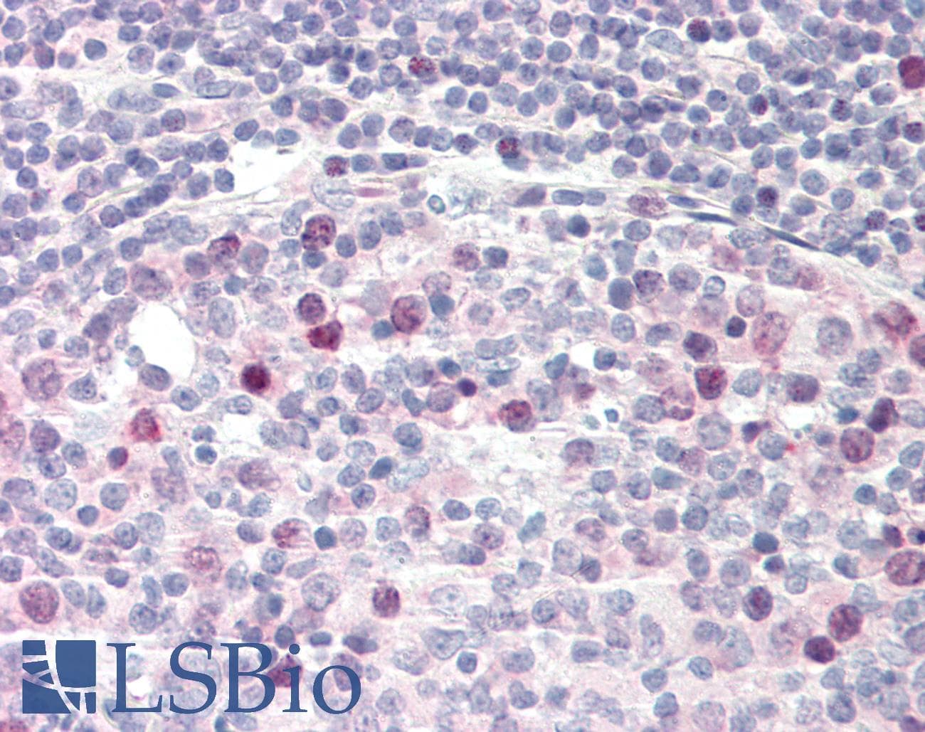 IHC-plus™ TPX2 Antibody (clone 19AT738.292)