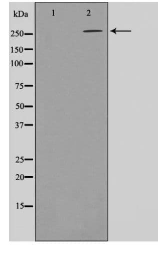 Polyclonal Rabbit anti-Human Acetyl-CoA Carboxylase / ACC Antibody (phospho-Ser80, IHC, WB)