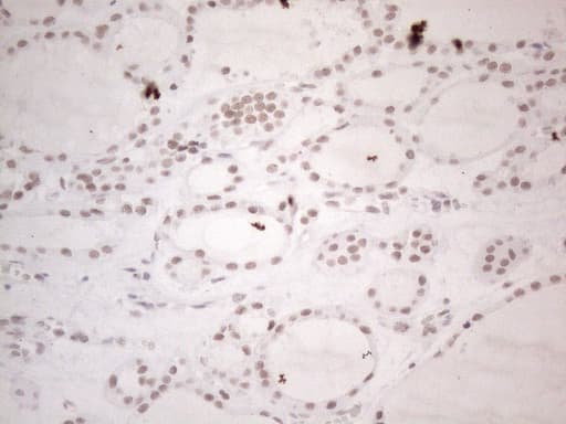 NR2C2 / TAK1 Antibody (aa1-241, clone OTI2H2)