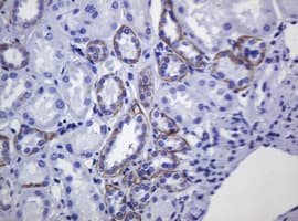CDH1 / E Cadherin Antibody (clone OTI3E2)