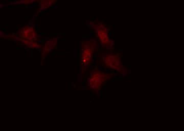 PPP1R1B / DARPP-32 Antibody (phospho-Thr75)