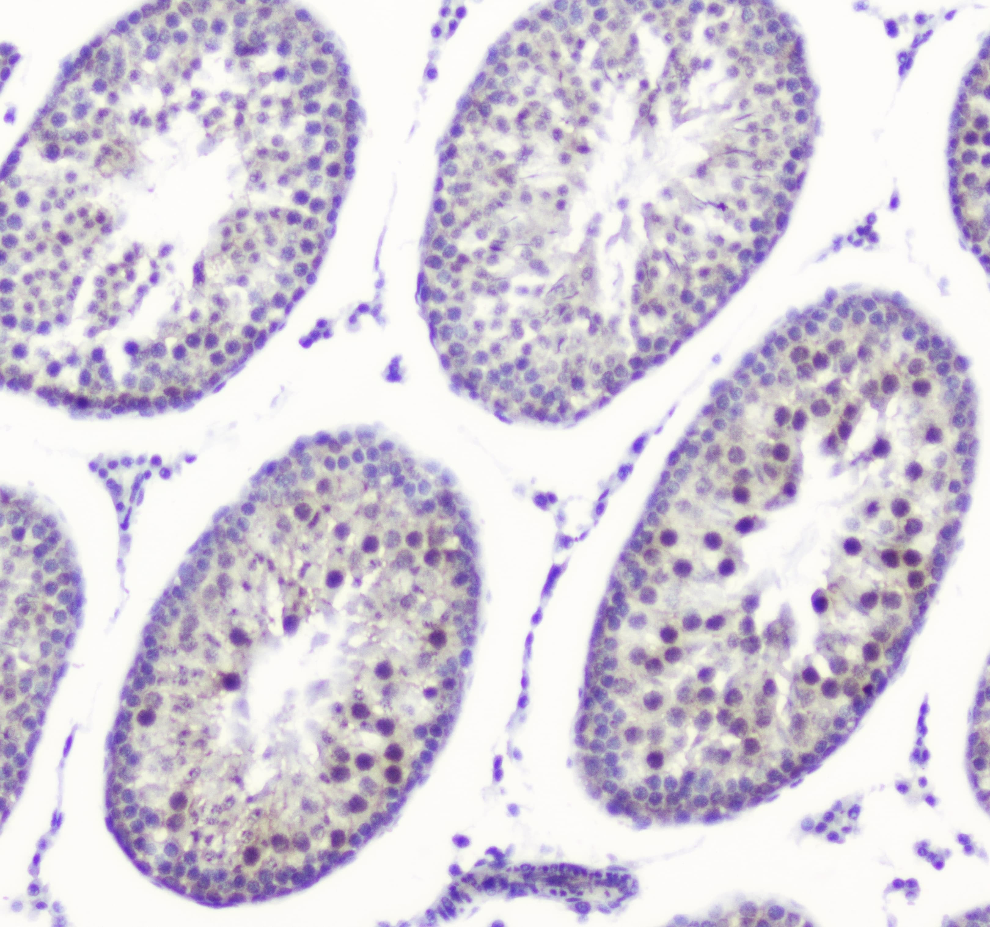 Polyclonal Rabbit anti-Human SMC6 Antibody (WB)