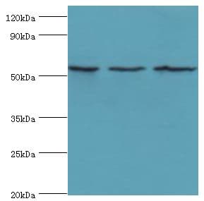 Polyclonal Rabbit anti-Human MYOT / Myotilin Antibody (aa443-498, IHC, WB)