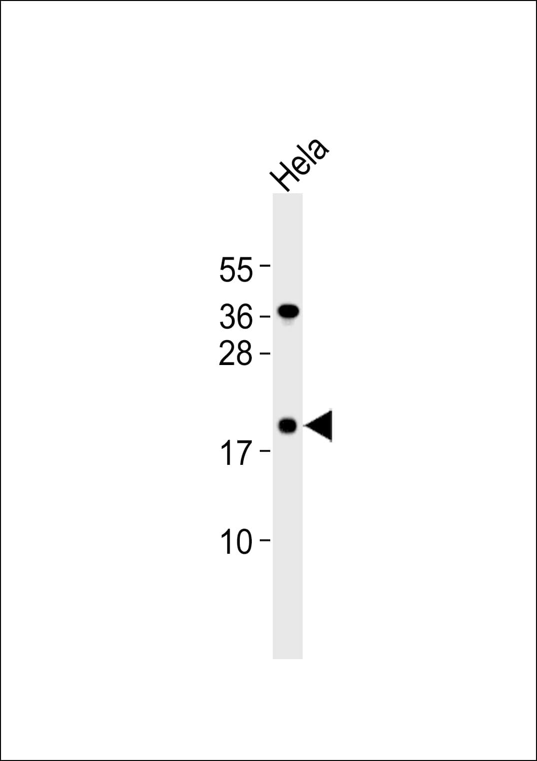 CLDN4 / Claudin 4 Antibody