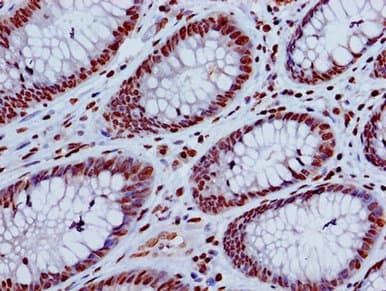 HIST1H4I Antibody